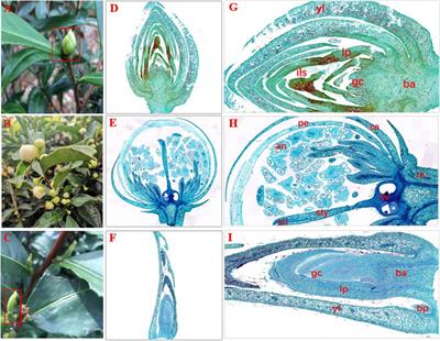 Transcriptomic and Metabolomic Analyses Provide Insights Into an Aberrant Tissue of Tea Plant (Camellia sinensis)